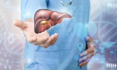 Liver Transplant Guide,Procedure, Eligibility & Recovery