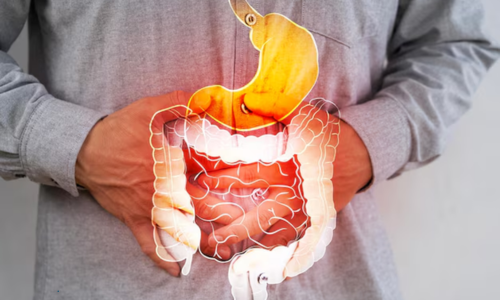 Common Gastrointestinal Diseases, Symptoms, Causes, and Treatment Options